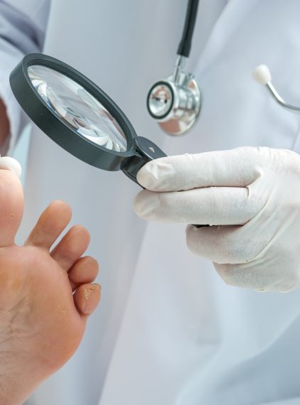 Grzybica skóry gładkiej – przyczyny, objawy, leczenie