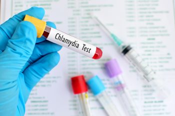 Chlamydia. Jakie są objawy chlamydiozy?