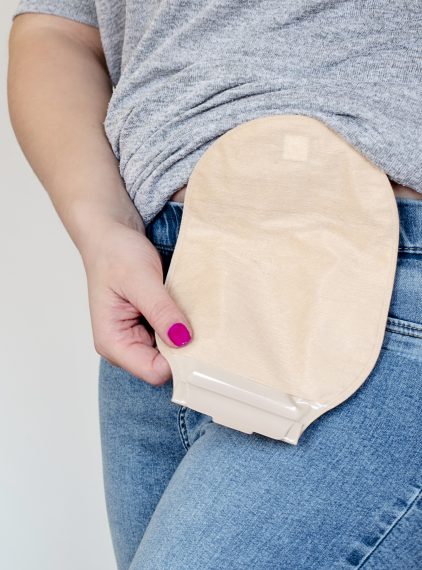 Dieta przy stomii – jak ją komponować?