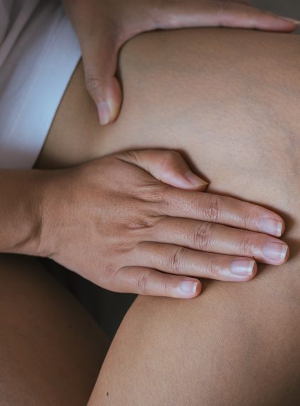 Siność siatkowata – przyczyny, diagnostyka i leczenie