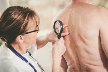 Piodermia zgorzelinowa – przyczyny, objawy, leczenie