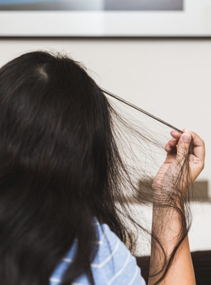 Trichotillomania. Dlaczego niektórzy rwą włosy z głowy?