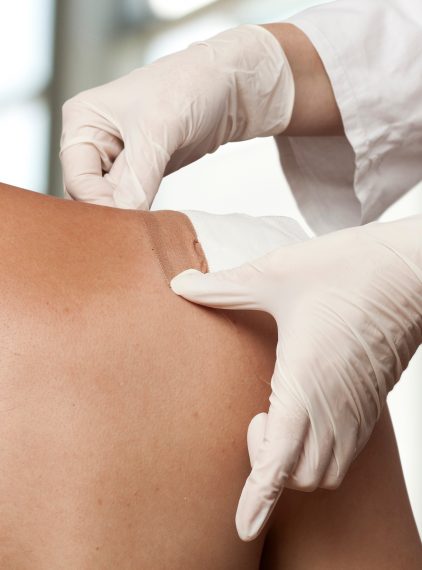 Opatrunki ze srebrem – czy są skuteczne?