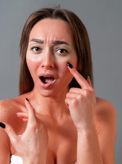 Opuchlizna na twarzy po opalaniu. Co zastosować?