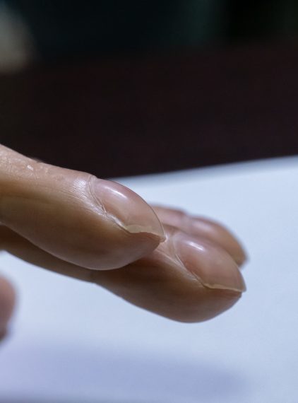 Palce pałeczkowate – o czym mogą świadczyć?