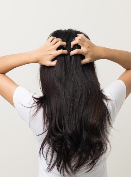 Dermatillomania. Niszczy nie tylko skórę!