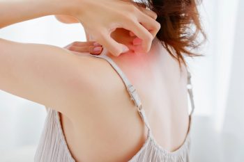 Radioterapia – jakie skutki uboczne wywołuje?