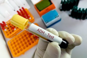 Wazopresyna – działanie, funkcje. Kiedy wykonuje się badanie wazopresyny?