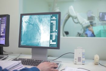 Angiografia – na czym polega?