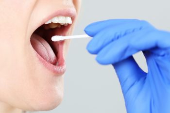 Wymaz z gardła – wskazania, przygotowanie i przebieg