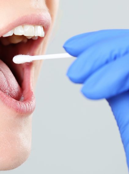 Wymaz z gardła – wskazania, przygotowanie i przebieg