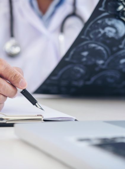 Glejak mózgu. Jak rozpoznać objawy?