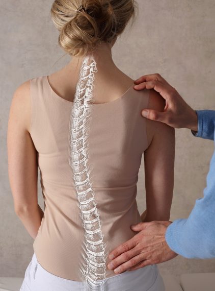 Skolioza. Co to za wada postawy?