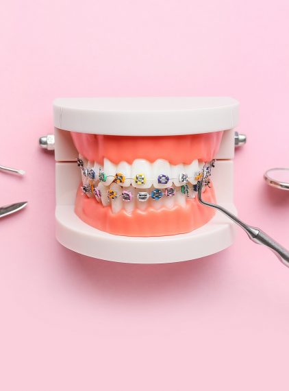 Wady zgryzu. Poznaj rodzaje i metody leczenia