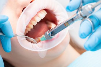 Znieczulenie u dentysty. Kiedy możesz z niego skorzystać?