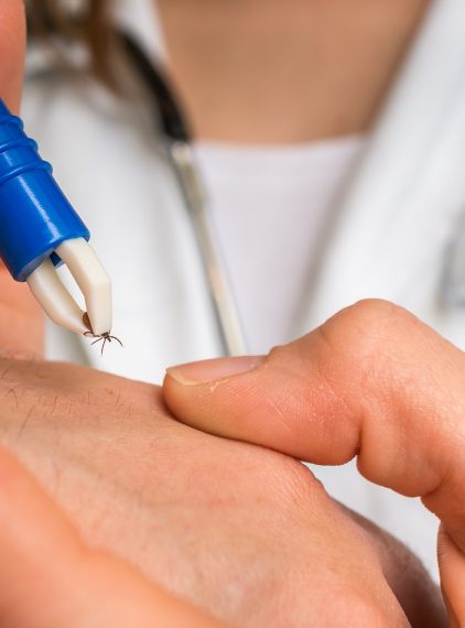 Badanie kleszcza. Czy wykrywa boreliozę?  