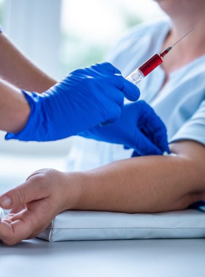 Fosfataza zasadowa. Jakie są normy?