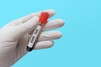 Badanie eGFR. Na co wskazuje jego wynik?