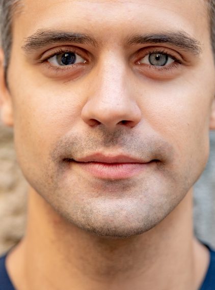 Gdy tęczówki różnią się kolorem. Heterochromia