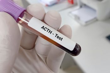 Choroba Addisona. Czy jest niebezpieczna? 
