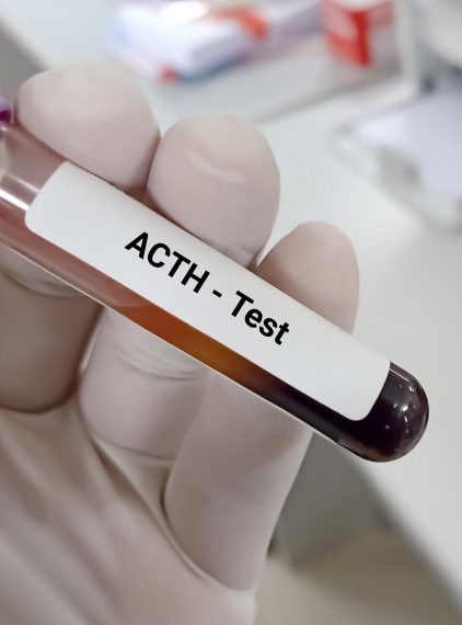 Choroba Addisona. Czy jest niebezpieczna? 