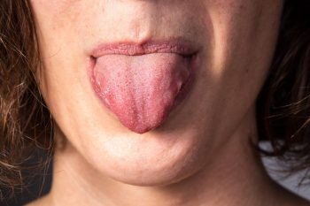 Pieczenie języka. O jakich chorobach może świadczyć?