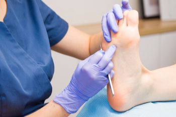 Odciski na stopach. Jak sobie z nimi radzić?