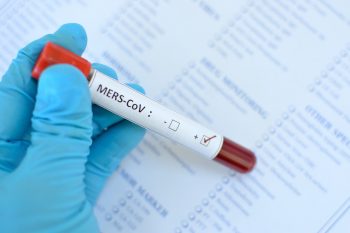 Wirus MERS. Czy nadal stanowi zagrożenie?