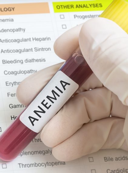 Anemia megaloblastyczna. Jak możemy jej zapobiec?