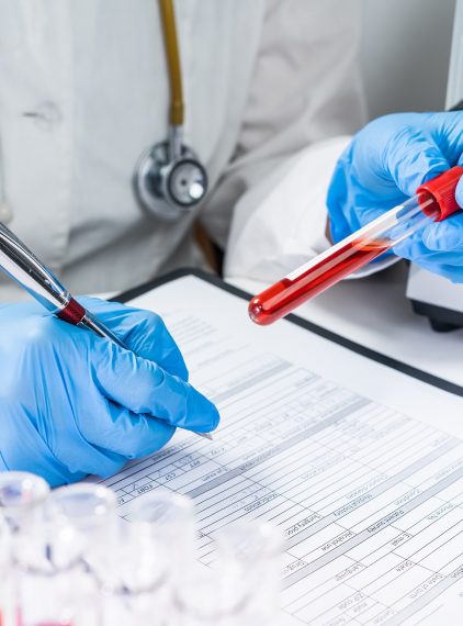 Przewlekła białaczka szpikowa. Jakie jest rokowanie?