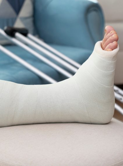Złamanie kości śródstopia. Jak je leczyć?