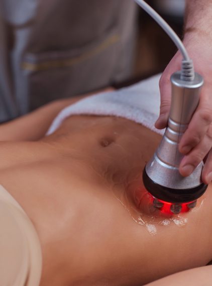 Liposukcja kawitacyjna. Modelowanie bez skalpela 