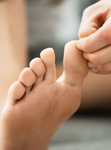 Badanie mykologiczne. Kiedy jest konieczne?