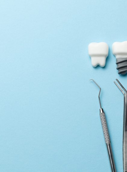 Implant zęba. Kiedy trzeba go wstawić?