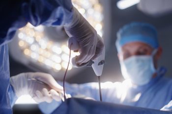 Laparoskopia. Kiedy wykonać zabieg?