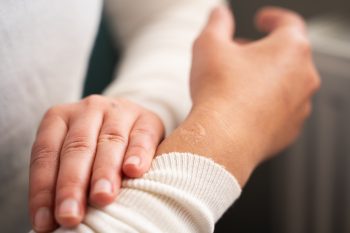 Czy dbanie o bliznę ma znaczenie? Fakty i mity