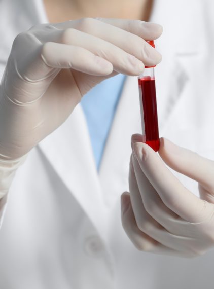 Eozynocyty. O czym świadczą obniżone lub podwyższone wyniki