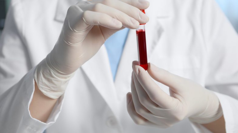 Eozynocyty. O czym świadczy obniżony lub podwyższony poziom?