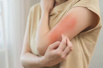 Gdy skóra nie daje spokoju. Jak zadbać o suchą i atopową skórę dzieci i dorosłych?