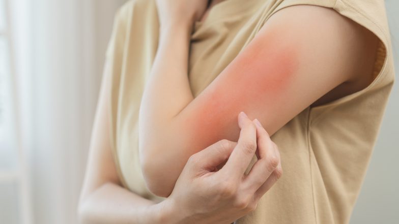 Gdy skóra nie daje spokoju. Jak zadbać o suchą i atopową skórę dzieci i dorosłych?