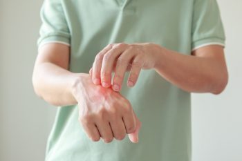 Najlepsza maść na ukąszenia. Przegląd preparatów