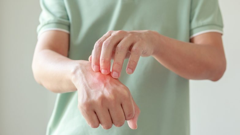 Najlepsza maść na ukąszenia. Przegląd preparatów