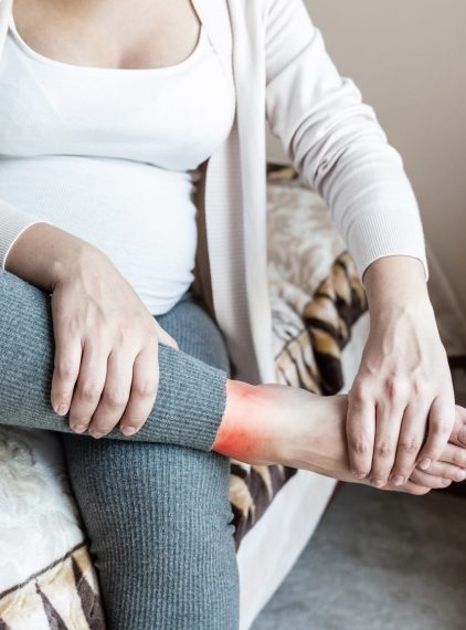 Obrzęk nóg w ciąży. Kiedy opuchlizna w ciąży jest niebezpieczna