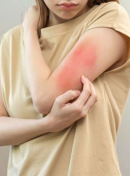 Przegląd leków na alergię bez recepty. Który wybrać i na co zwrócić uwagę?