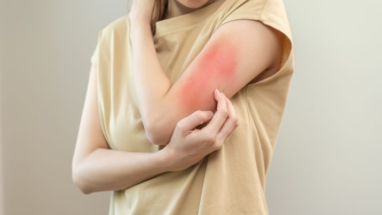 Przegląd leków na alergię bez recepty. Który wybrać i na co zwrócić uwagę?