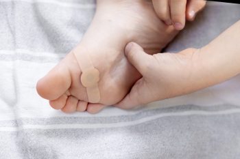 Odciski na stopach u dzieci. Jak je leczyć?