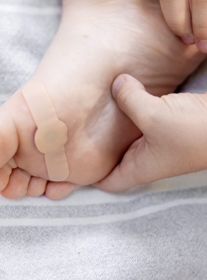 Odciski na stopach u dzieci. Jak je leczyć?
