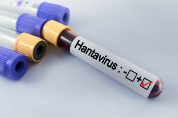 Hantawirus. Czym jest i czy może wywołać epidemię?
