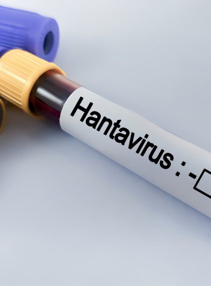 Hantawirus. Czym jest i czy może wywołać epidemię?
