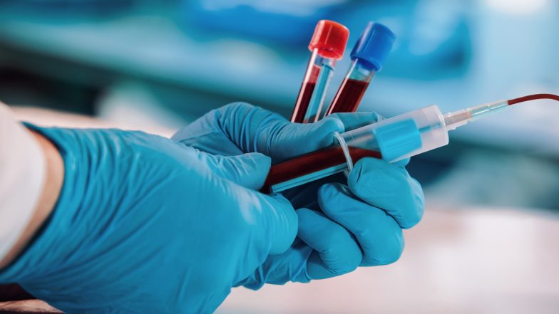 Lipoproteina (a). Normy, badanie i przyczyny podwyższonego wyniku